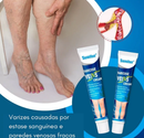 Pomada Varicose Veins - Acabe com as varizes