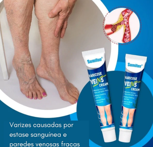 Pomada Varicose Veins - Acabe com as varizes
