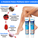Pomada Varicose Veins - Acabe com as varizes